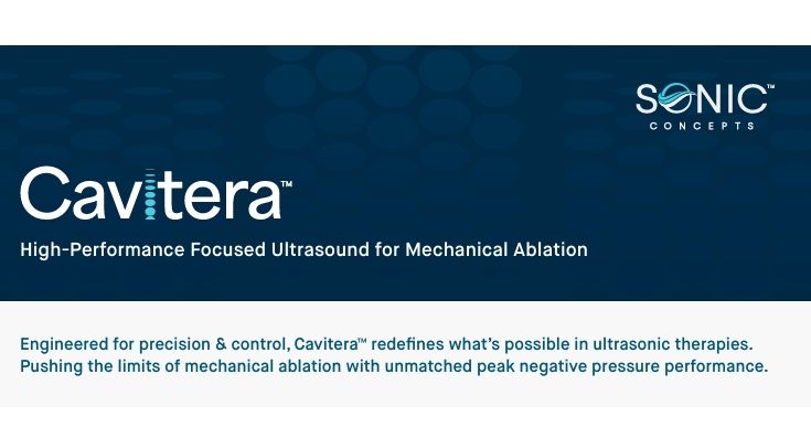 Cavitera：机械消融的高性能聚焦超声方案